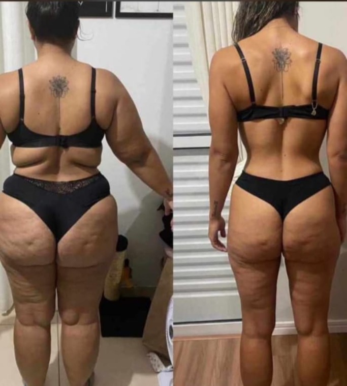 Antes e depois da Jessica com o método para emagrecimento Projeto Secreto