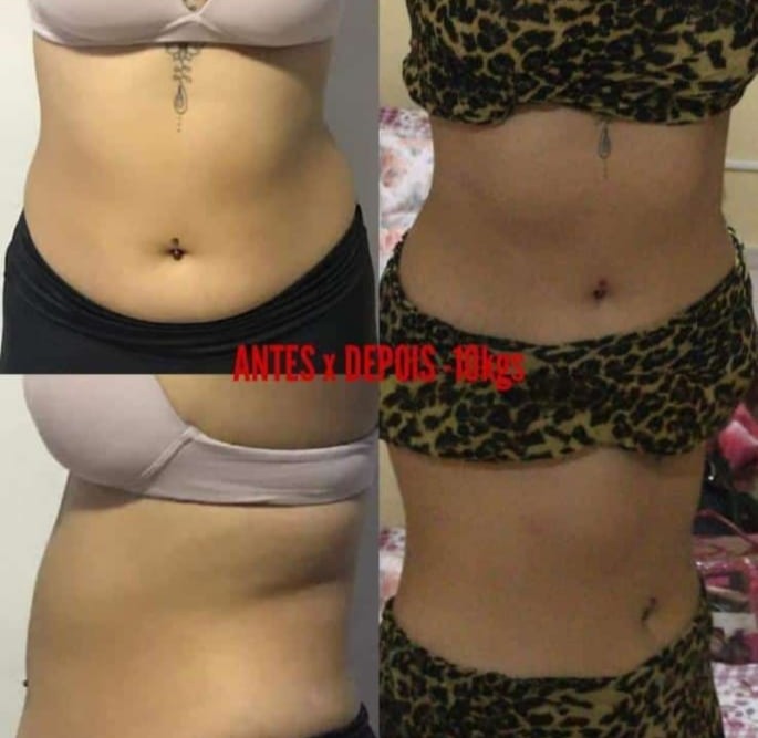 Antes e depois da Karen com o método para emagrecimento Projeto Secreto
